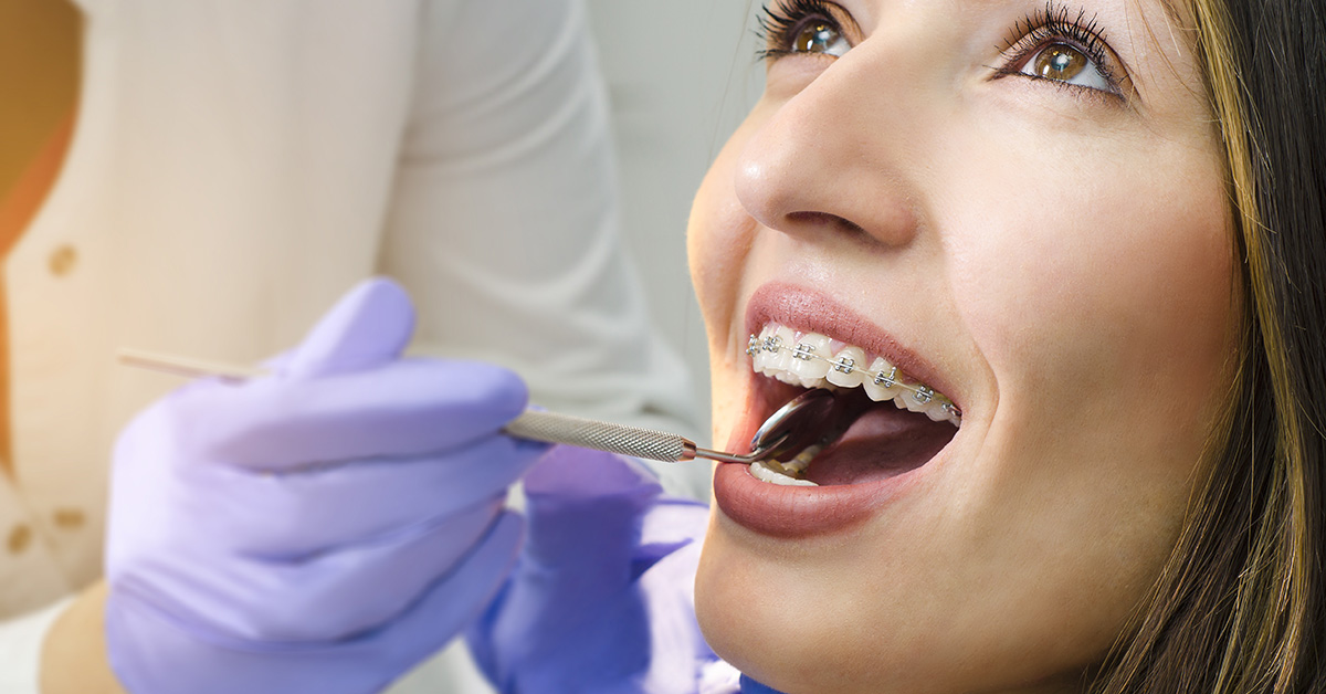 Why Your Practice Should Hire an Orthodontic Consultant